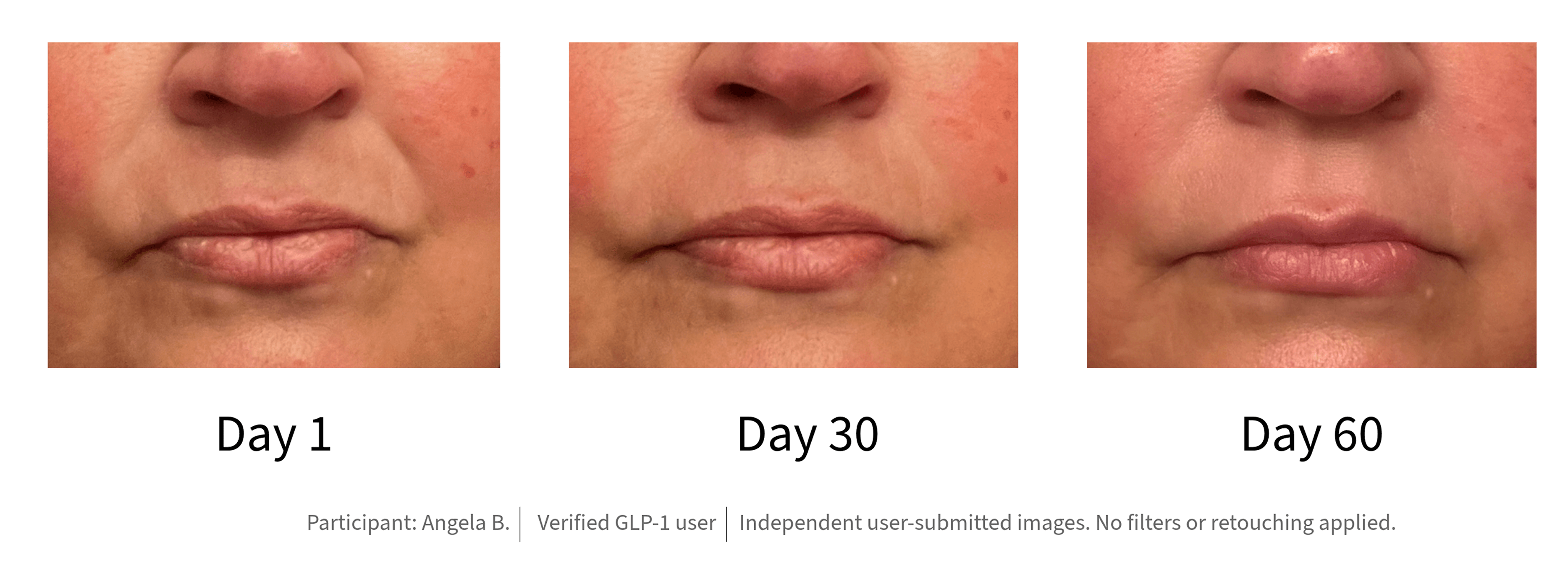 The Meticulous Continuum