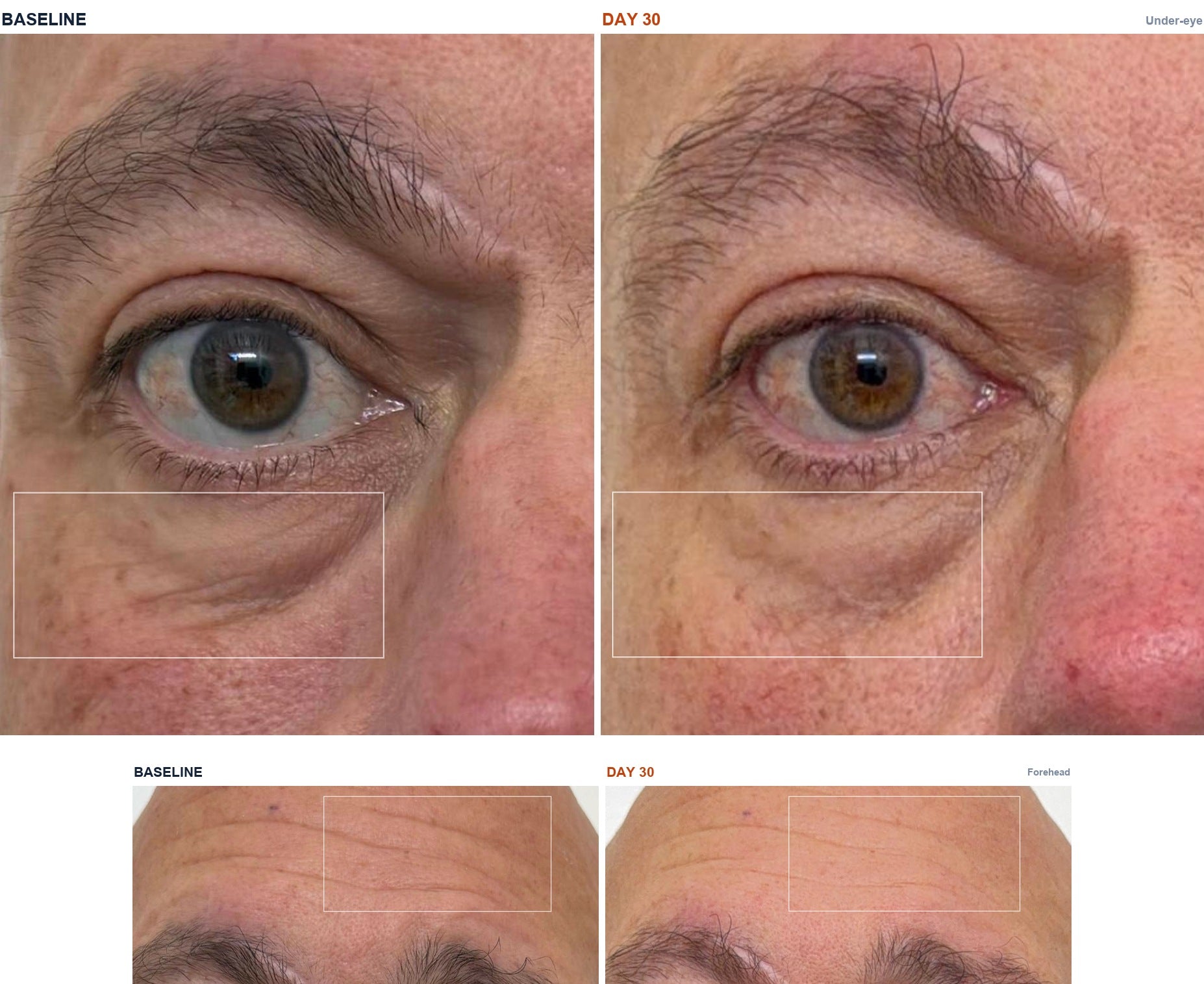Michael M. before and after