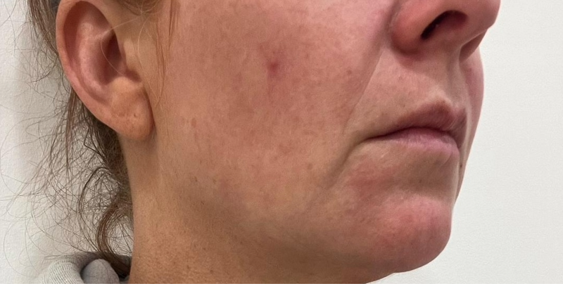 Before - Overall Texture