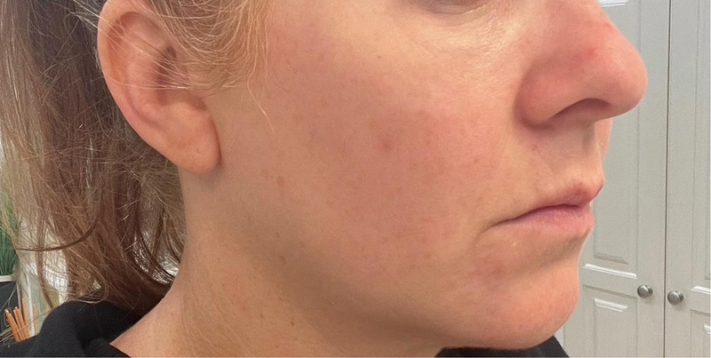 After - Overall Texture