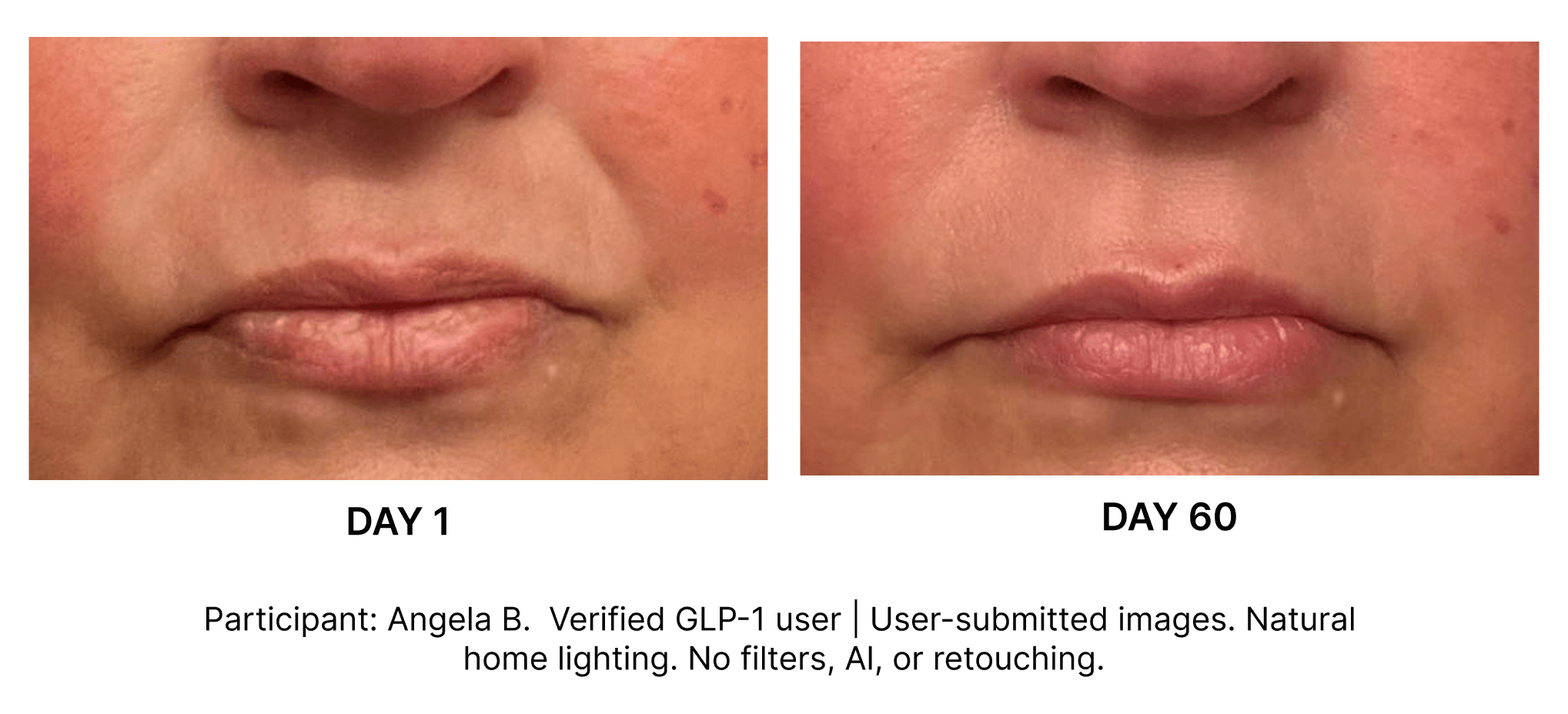 The Meticulous Continuum