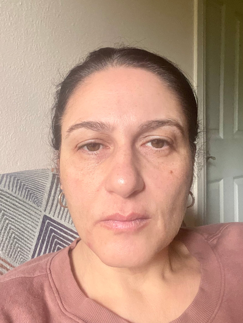 Baseline photo - Ivett