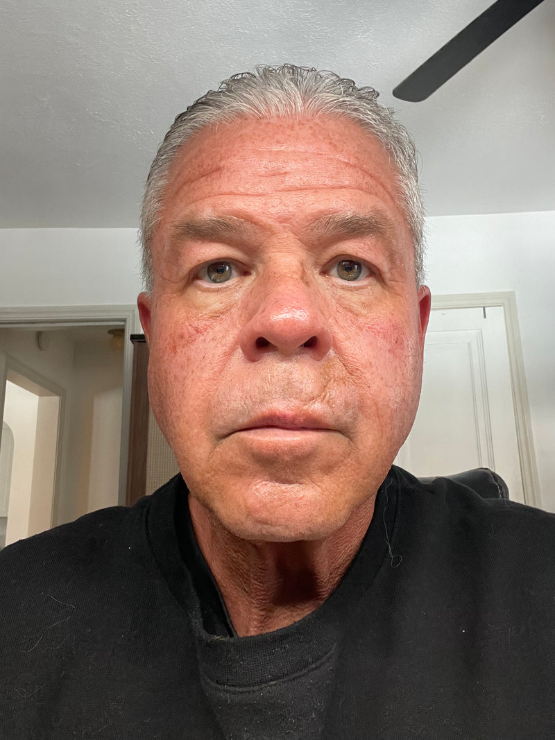 Baseline photo - Scott