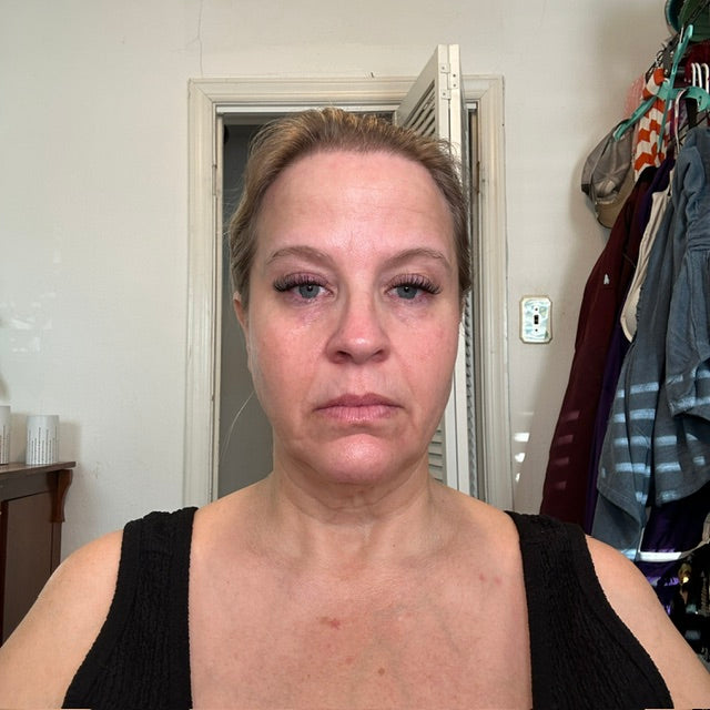 Baseline photo - Kindra