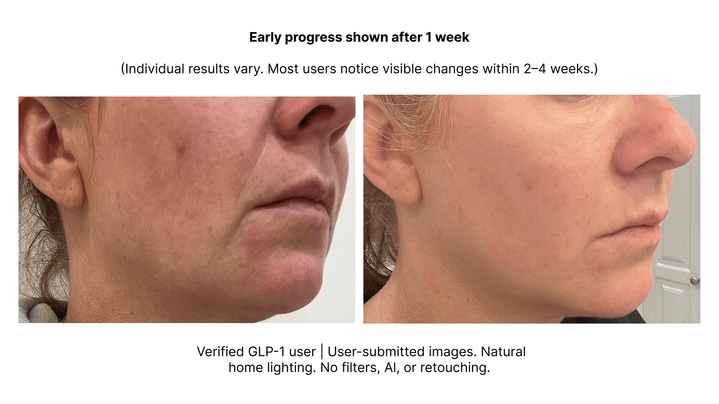 The Meticulous Continuum