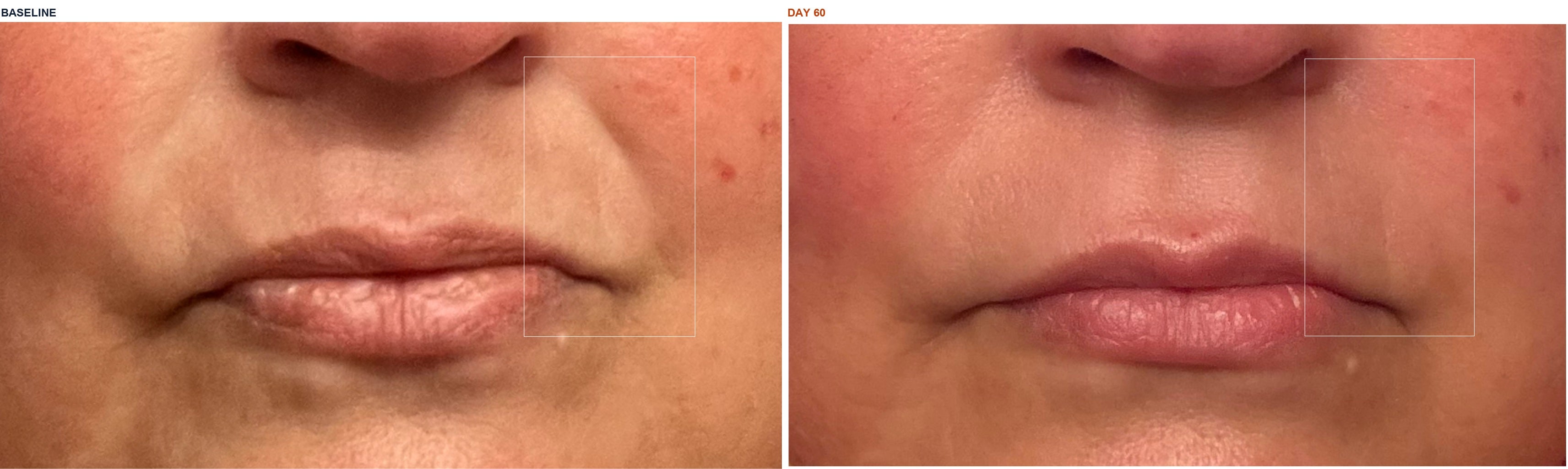 Angela L. before and after