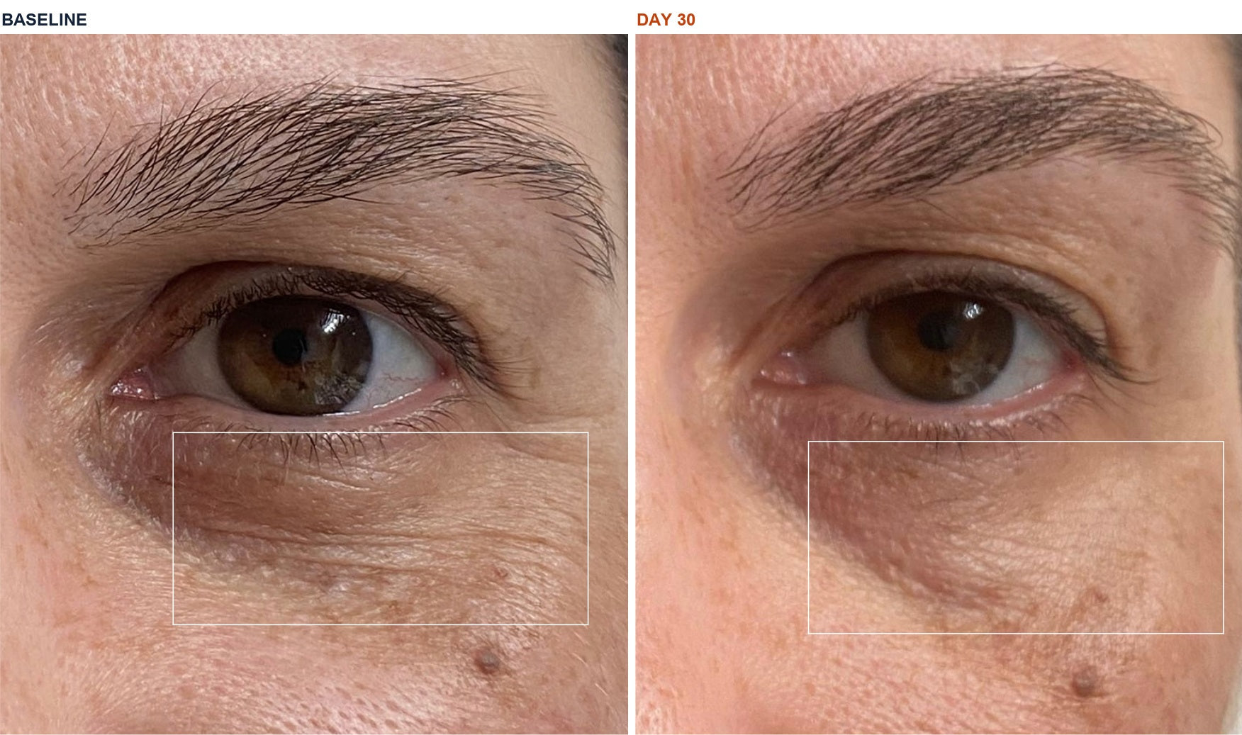 Ivet E. before and after