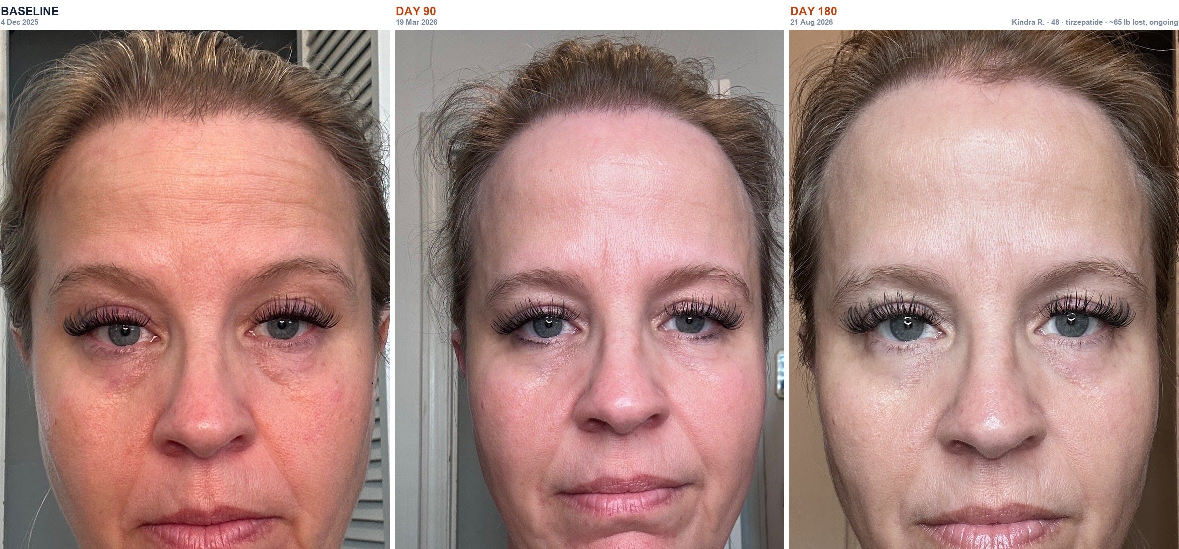Kindra R. before and after