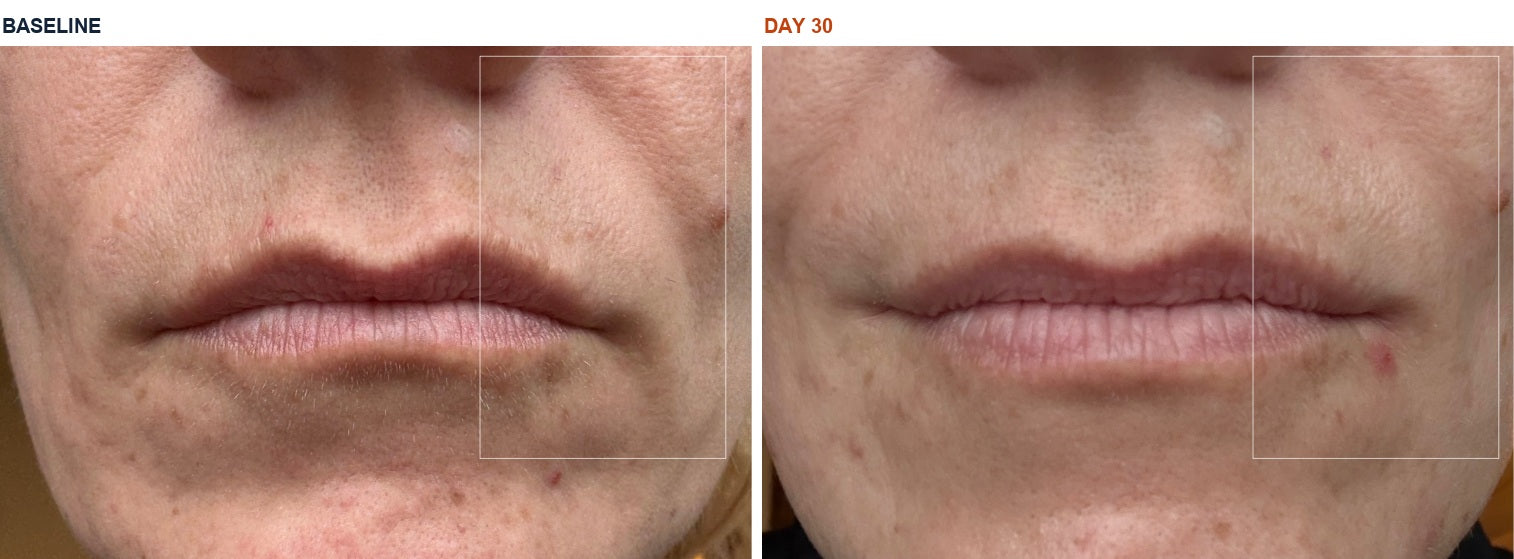 Meg C. before and after