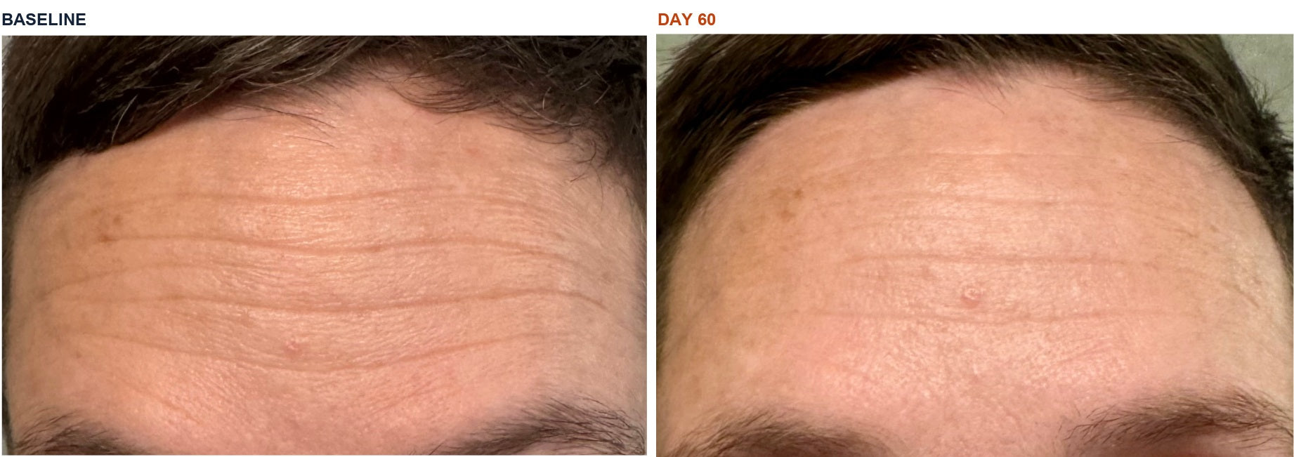 Sara M. before and after