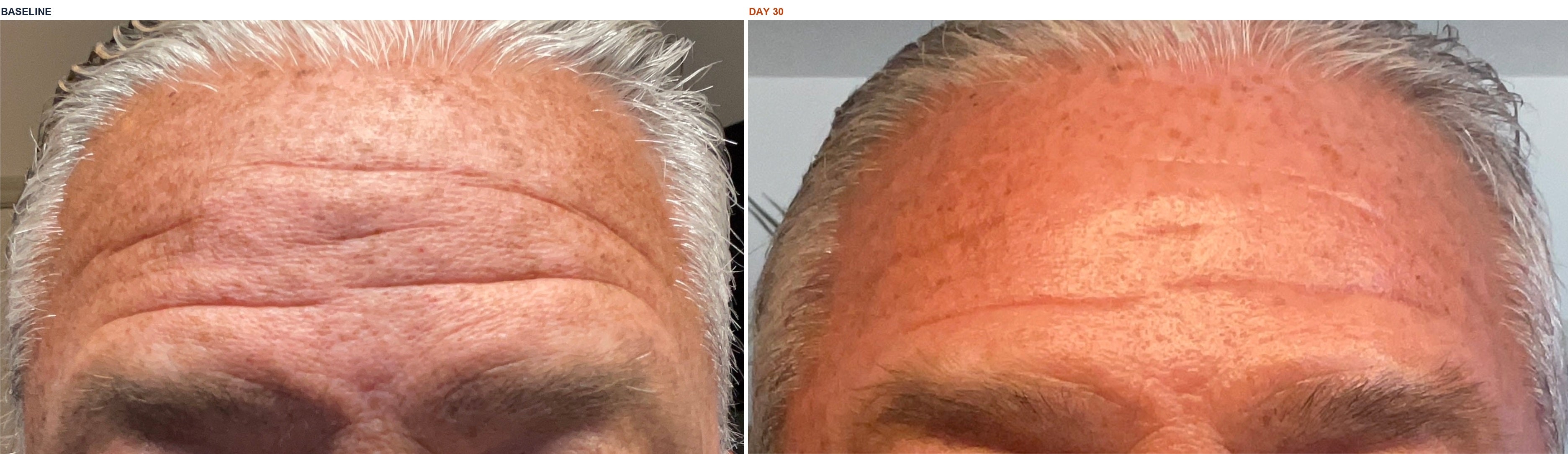Scott D. before and after